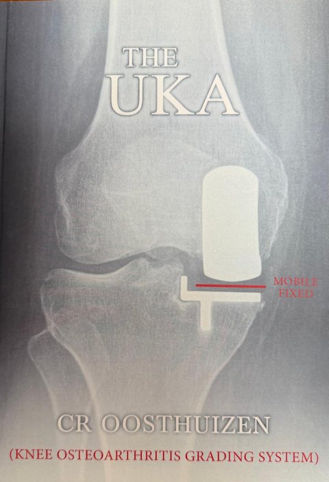 Cover of The UKA (Knee Osteoarthritis Grading System) by Dr CR Oosthuizen, 2019